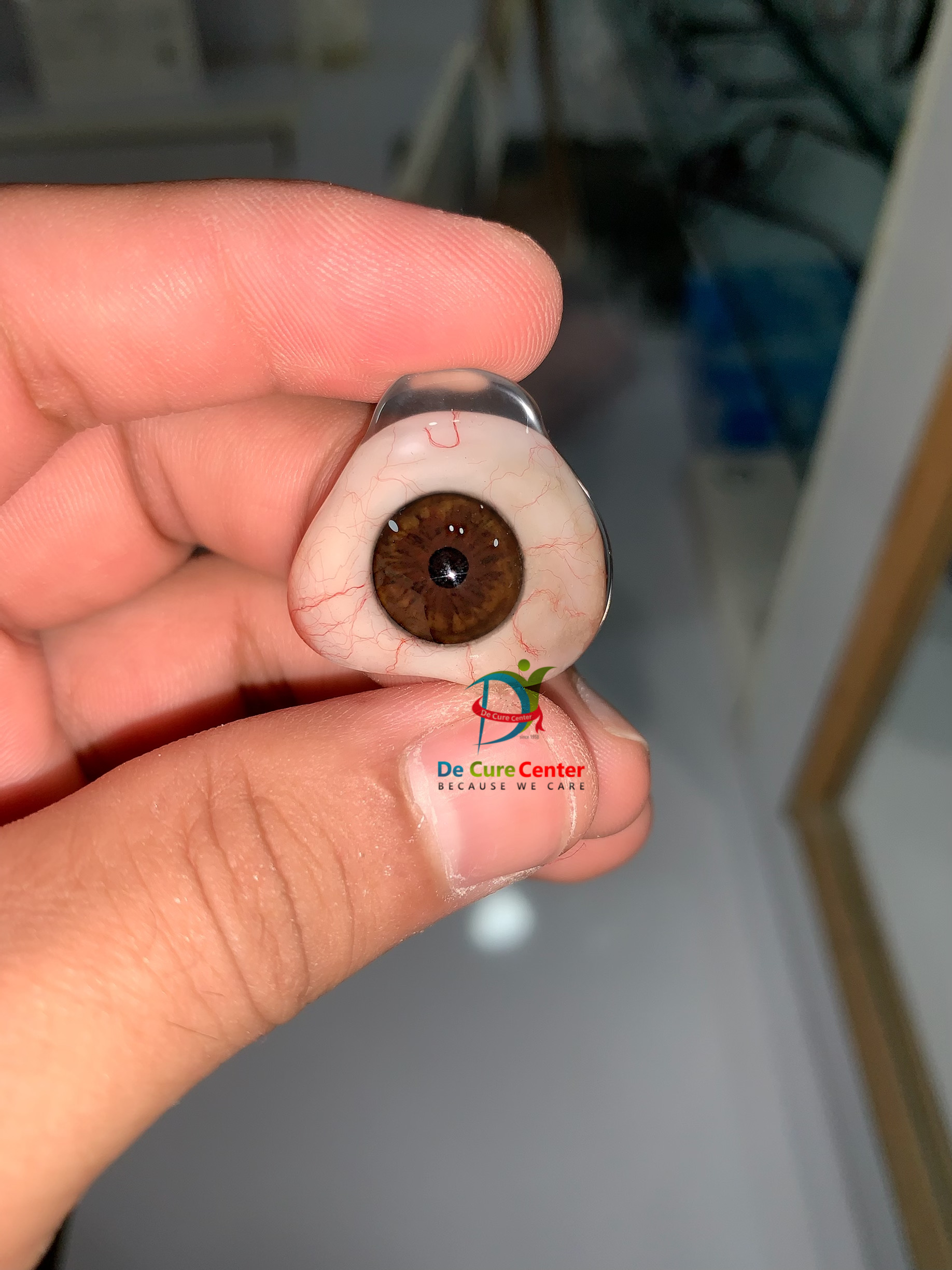 Custom Made Prosthetic Eye